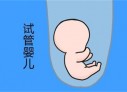 肾移植后可以青岛代怀孕青岛代生小孩吗